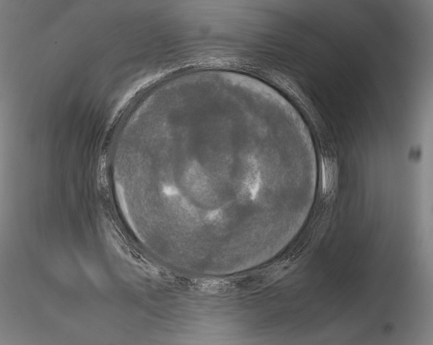 X0000114620579200912011003