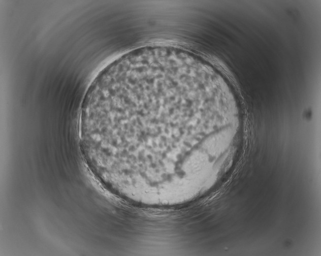 X0000114621036200912010956