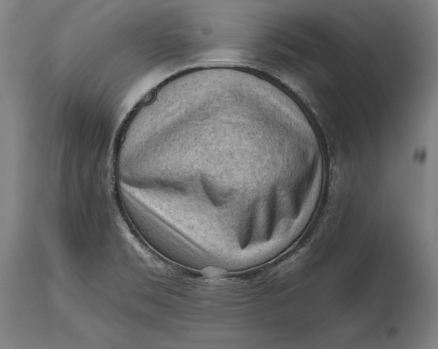 X0000114631469200911101225