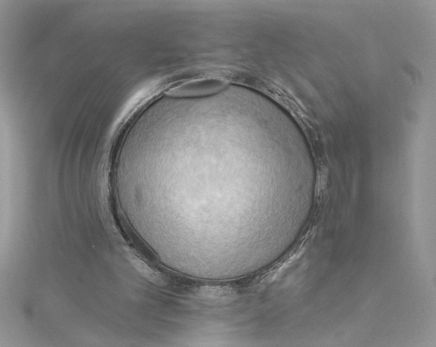 X0000114630101200911171018