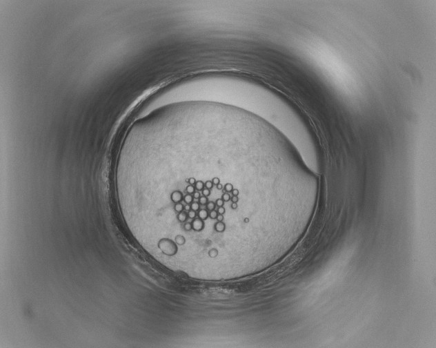 X0000114630387200911171014