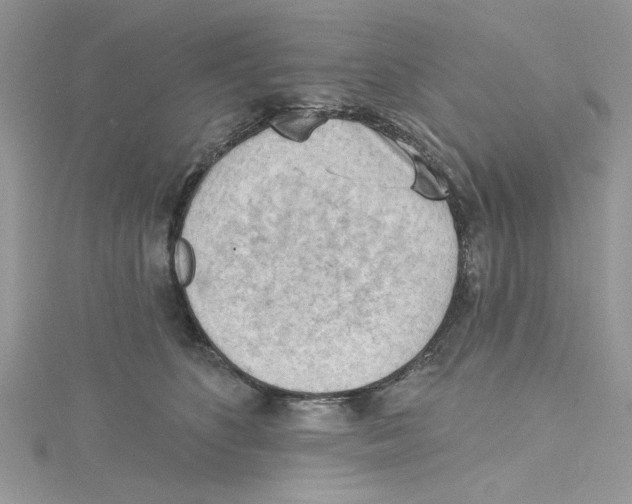 X0000114630516200911171013