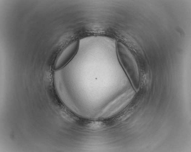 X0000114630609200911171011