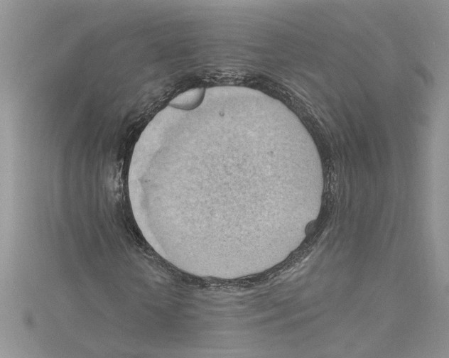 X0000114630818200911171008