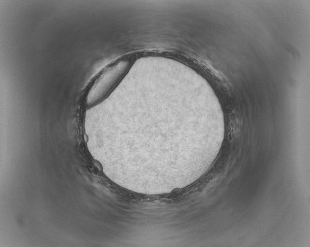 X0000114631256200911171002