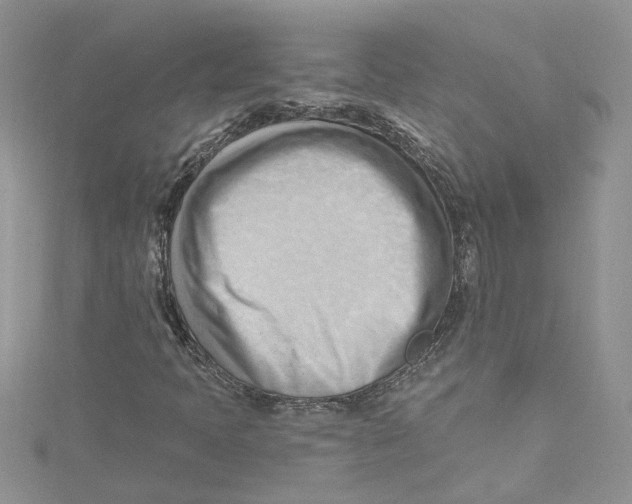 X0000114631397200911171000