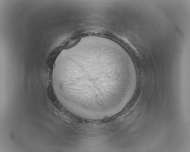 X0000114631399200911171000