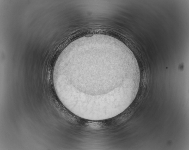 X0000114630417200912011029