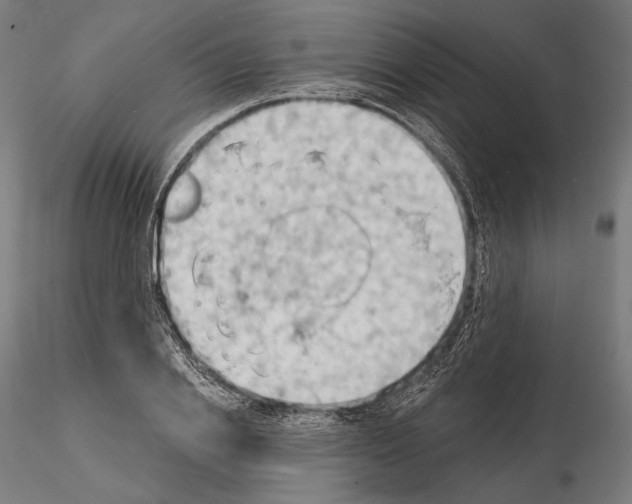 X0000114630838200912011023