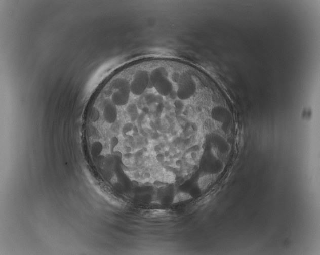 X0000114640151200911101306