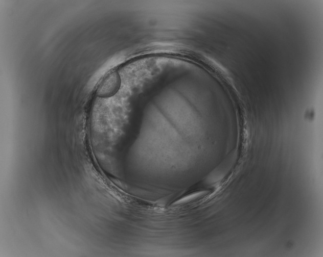 X0000114641411200911101248