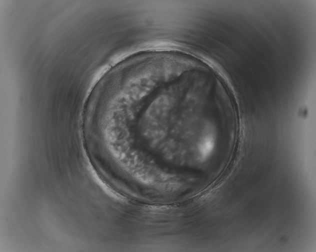 X0000114641429200911101248