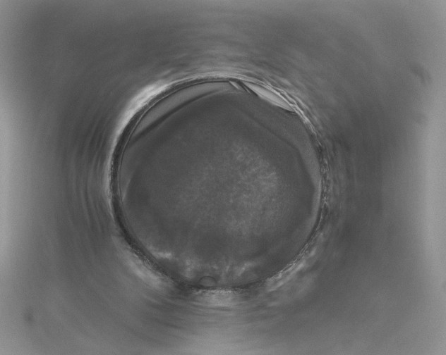X0000114640104200911171038