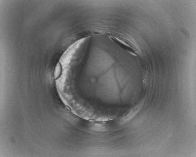 X0000114640285200911171036
