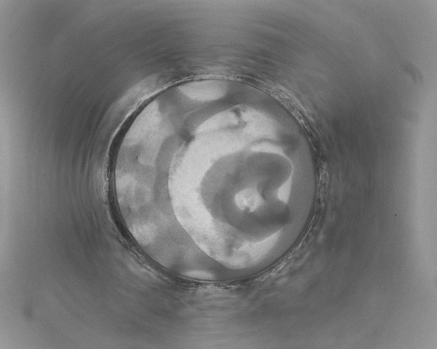X0000114640290200911171036