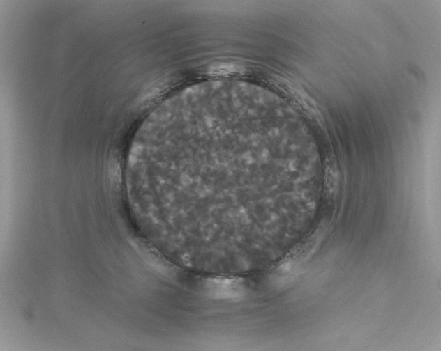 X0000114640375200911171035