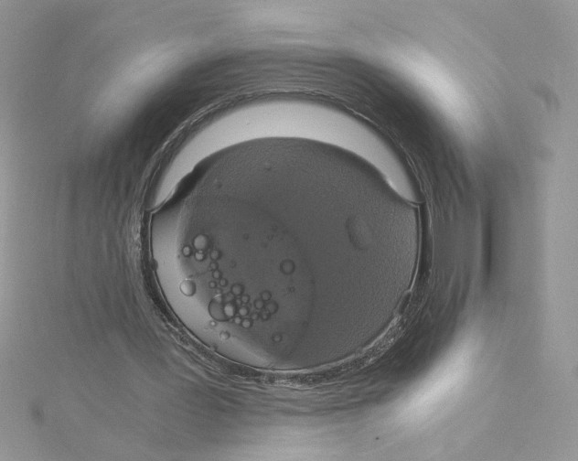 X0000114640387200911171034