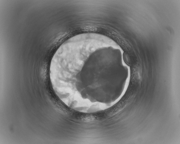 X0000114640600200911171031