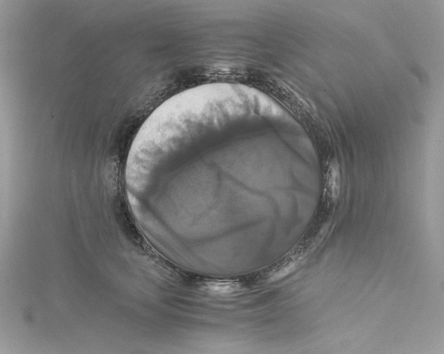 X0000114640659200911171031
