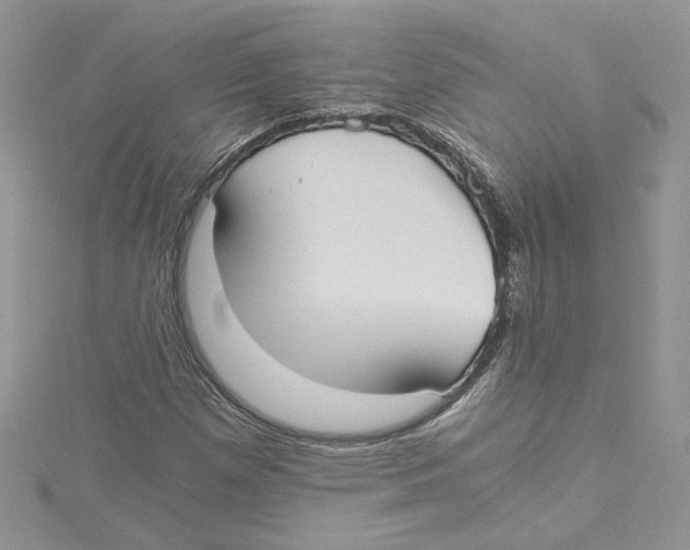 X0000114641257200911171023