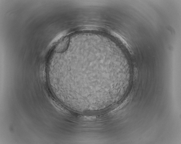 X0000114641403200911171021