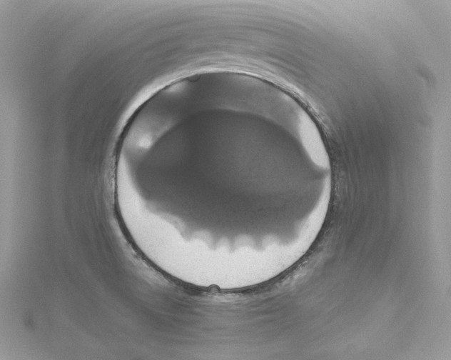 X0000114641522200911171020