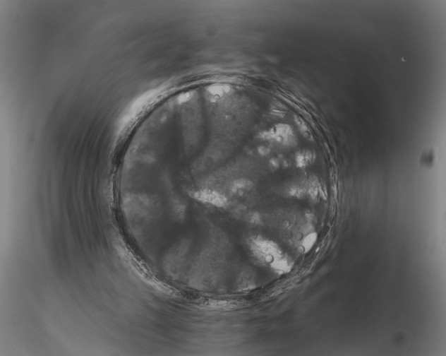 X0000114640149200912011056