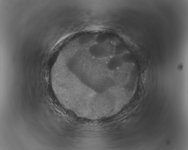 X0000114641206200912011041