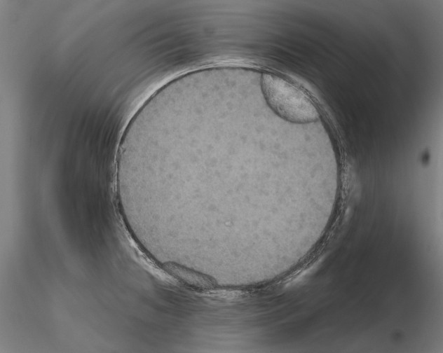 X0000114641236200912011041