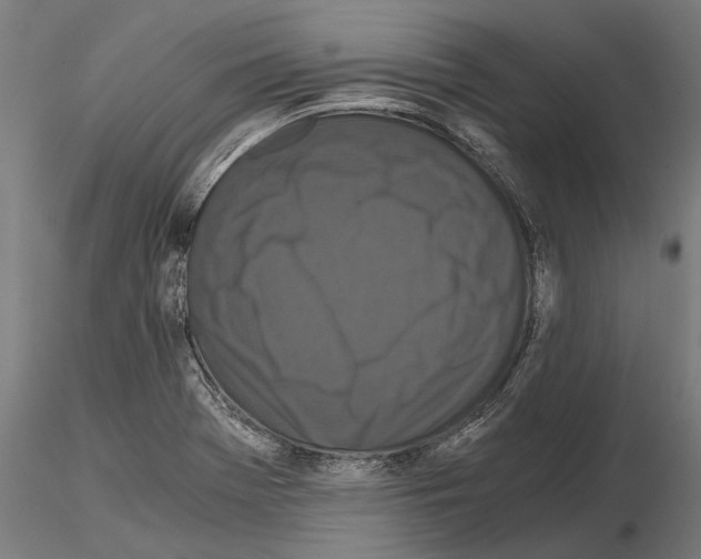 X0000114641369200912011039