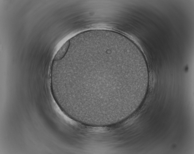 X0000114641387200912011038