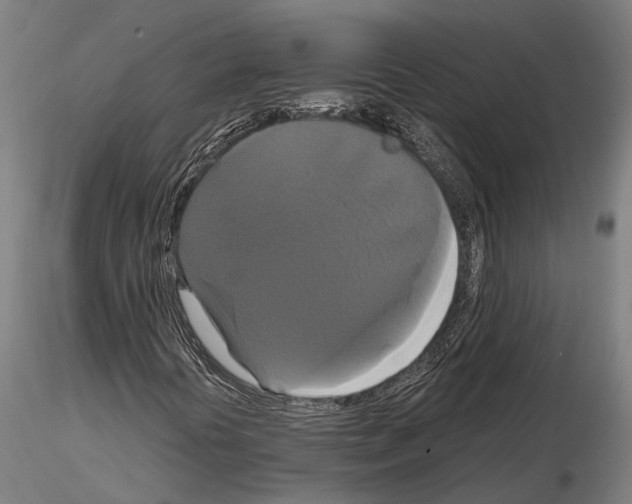 X0000114641394200912011038