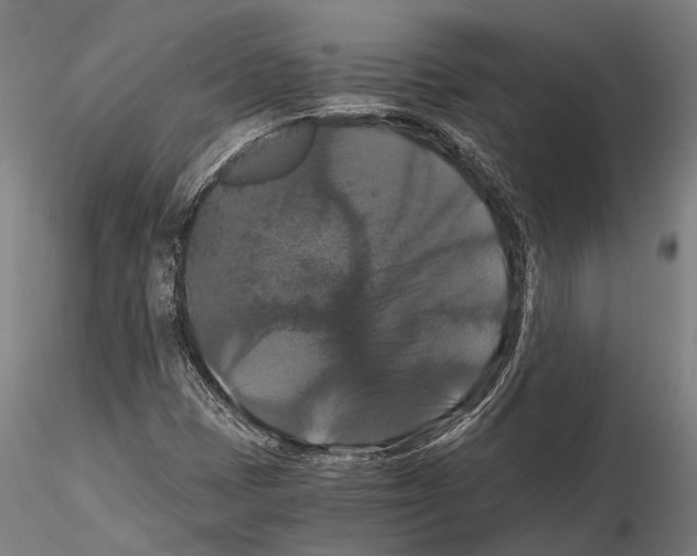 X0000114641401200912011038