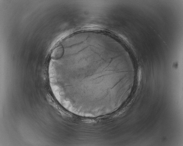 X0000114641405200912011038