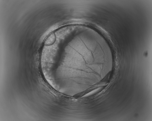 X0000114641411200912011038