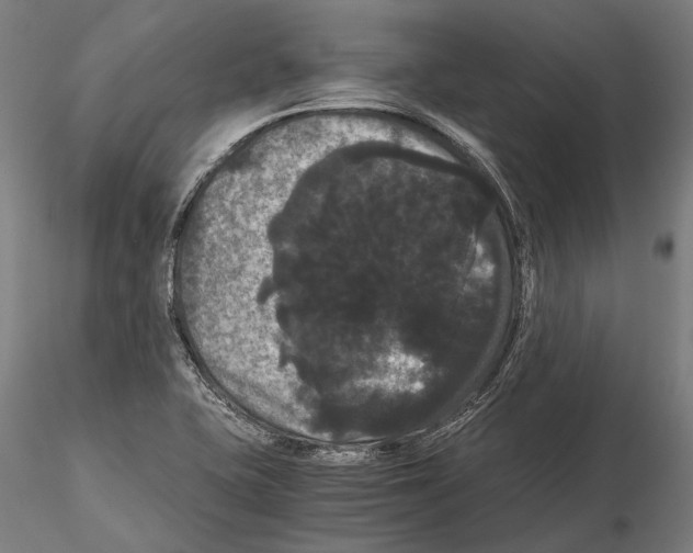 X0000114641415200912011038