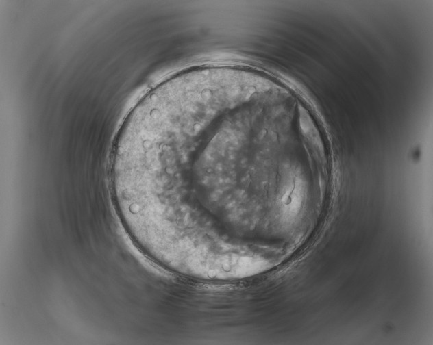 X0000114641429200912011038