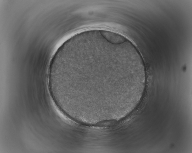 X0000114641523200912011037