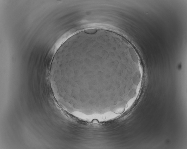 X0000114641529200912011037