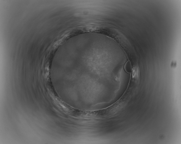 X0000114651011200910201504