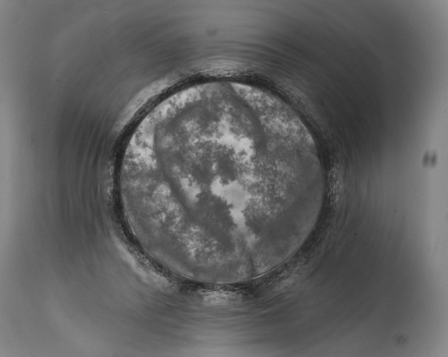 X0000114650400200911101325