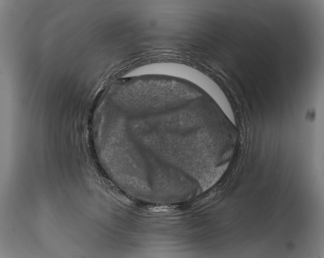 X0000114650516200911101323