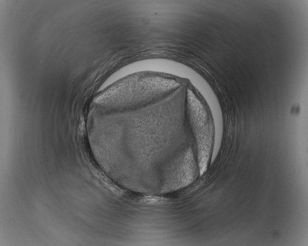 X0000114650617200911101322