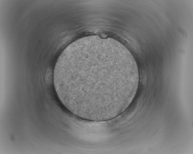 X0000114650036200911171059