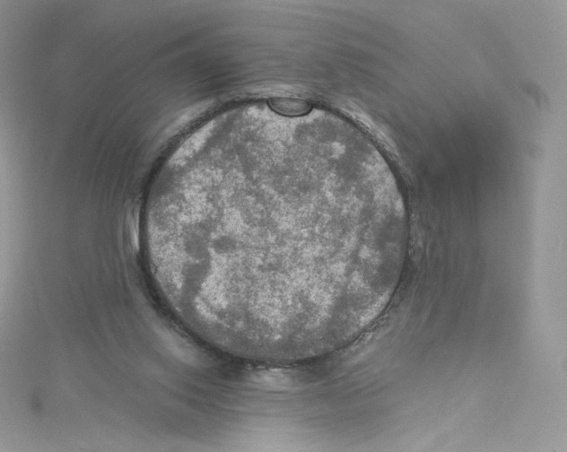 X0000114650062200911171058