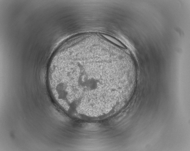 X0000114650107200911171058