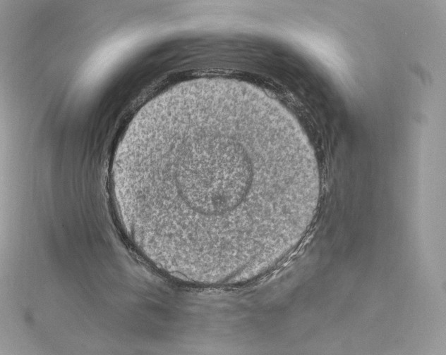 X0000114650146200911171057