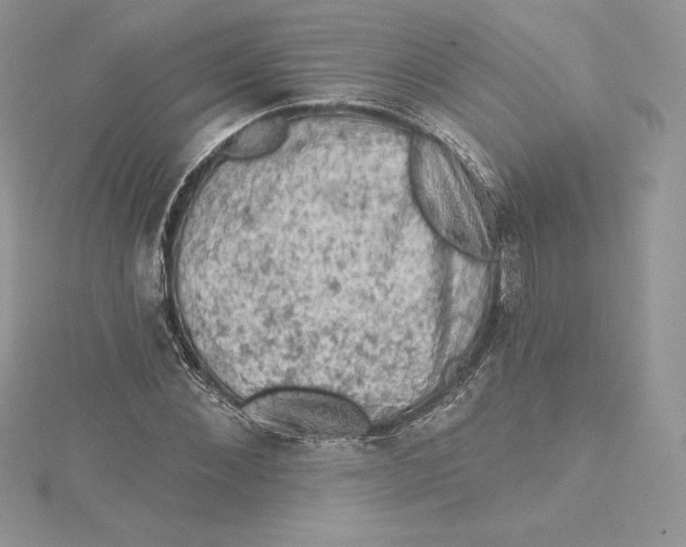 X0000114650876200911171048