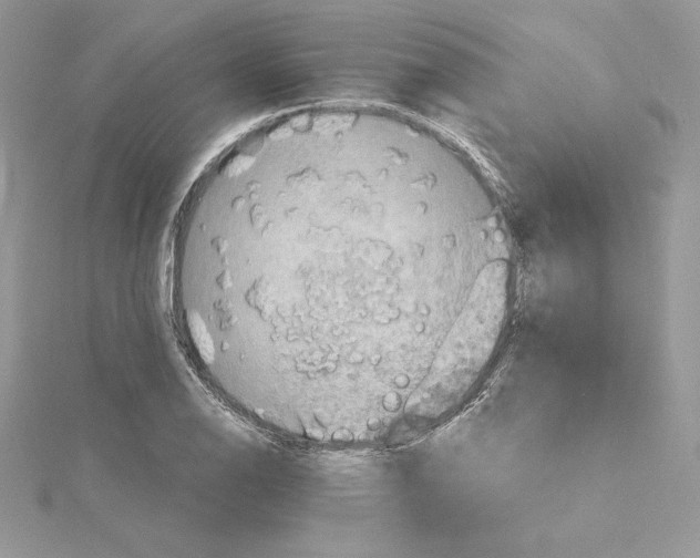 X0000114651126200911171045