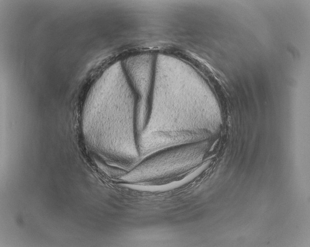 X0000114651447200911171041